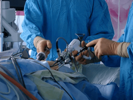 Intervenție chirurgicală